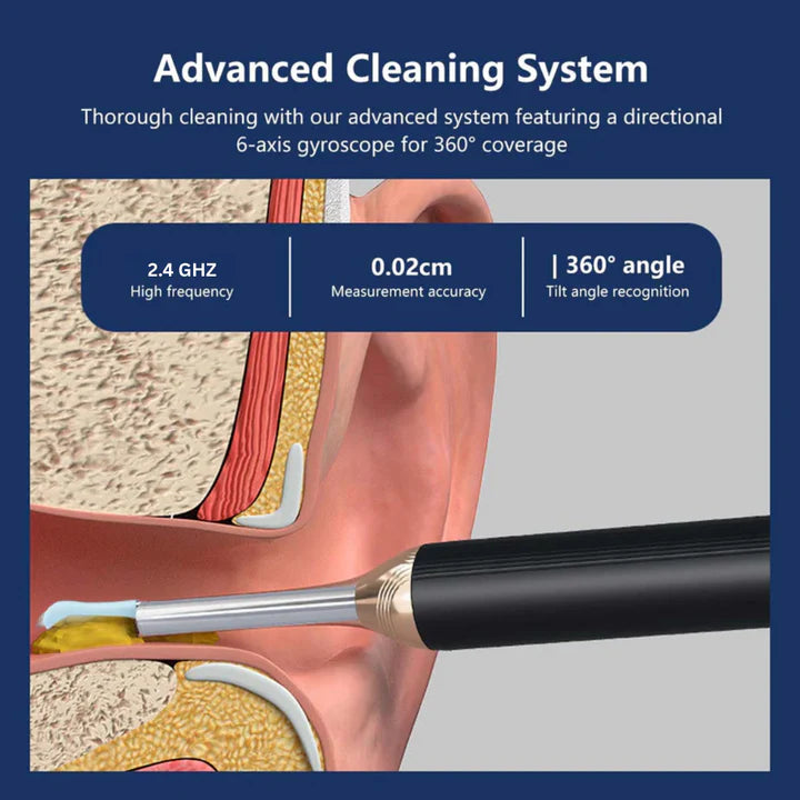 White Ear Wax Removal Tool with Camera – HD Ear Cleaner with 6 LED Lights